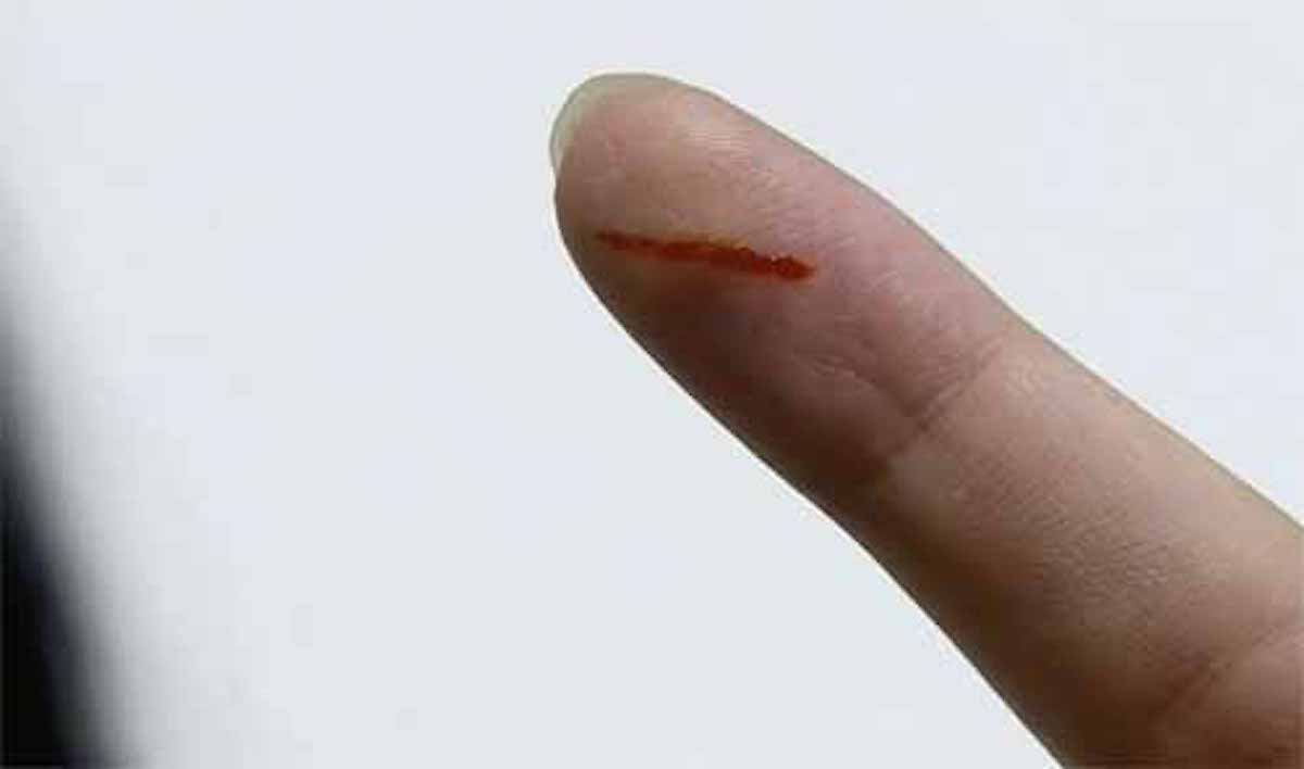 紙で指を切ると痛いのはなぜ？という話：チコちゃんに叱られる！【2019/10/04】