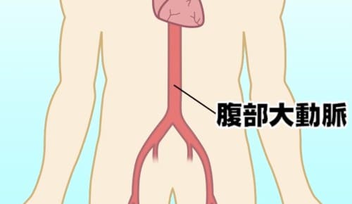 腹部大動脈